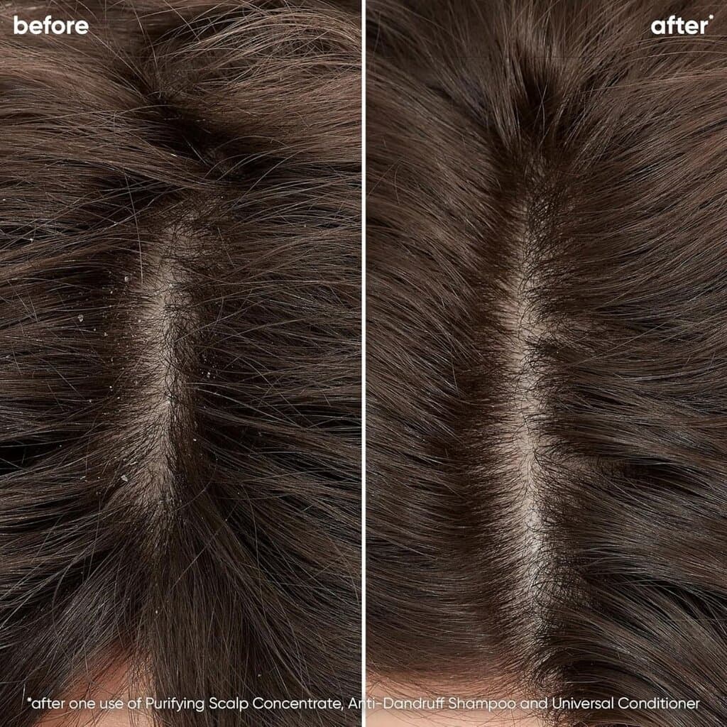 Biolage Scalp Sync Anti-Dandruff Shampoo - 400ml 2