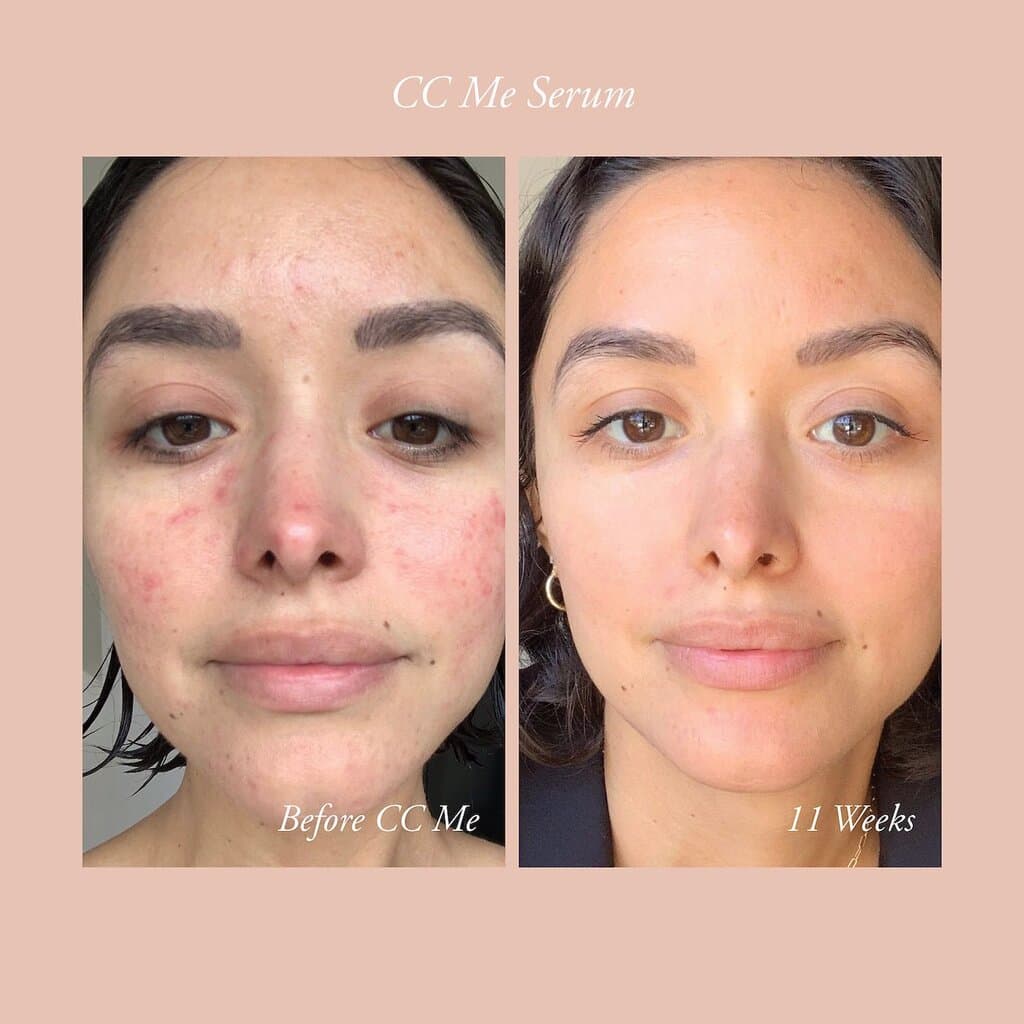CC ME SERUM WITH VITAMIN C + NIACINAMIDE 4