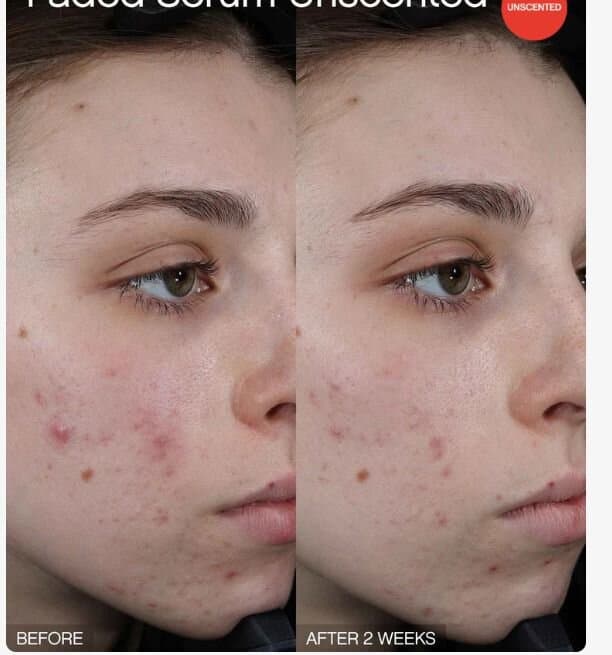 Topicals Faded Brightening + Clearing Serum/30ML 3