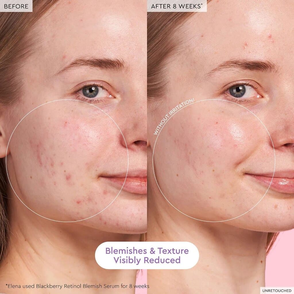 GLOW RECIPE blackberry retinol blemish serum/30ML 3