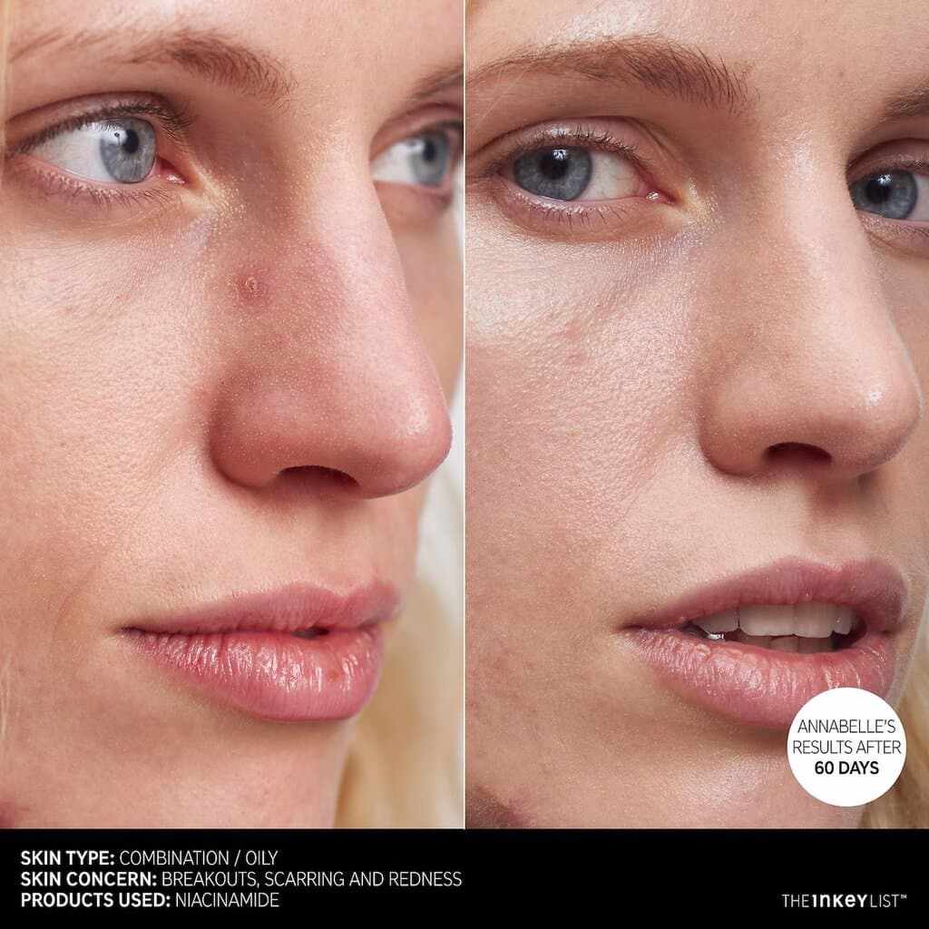 Niacinamide Oil Control Serum 8