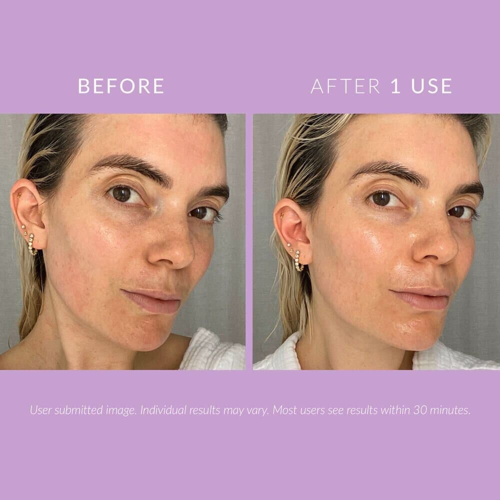 DELIKATE® RECOVERY CREAM 7