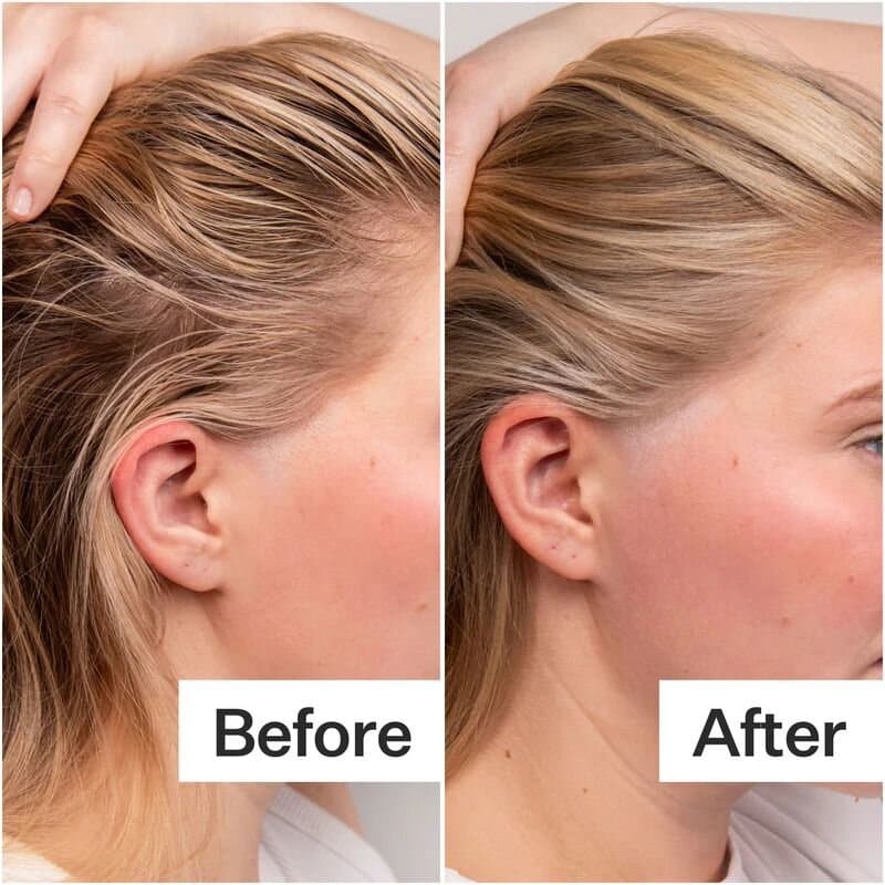 ACT + ACRE COLD PROCESSED STEM CELL SCALP SERUM /15ML 3