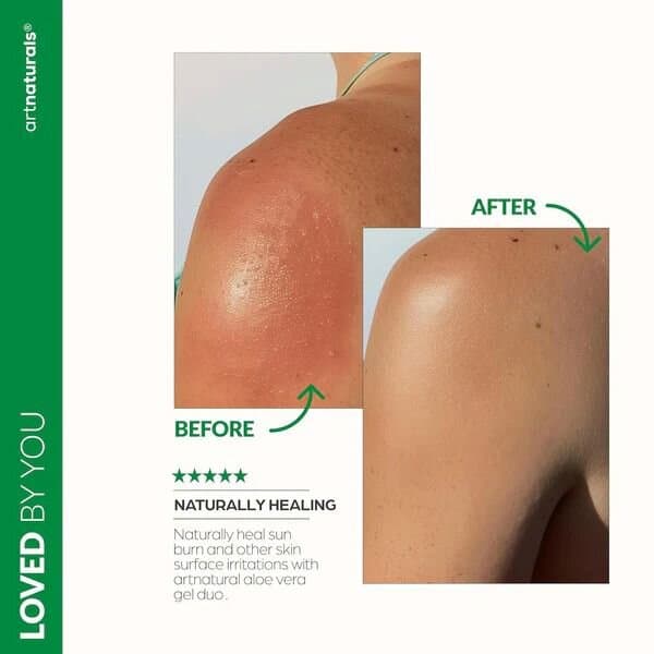 Artnaturals Aloe Vera Gel unburn Relief & Hydration for Face, Body, Scalp & Hair/354ML 2