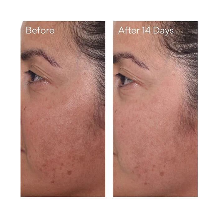 MURAD  Rapid Dark Spot Correcting Serum 2