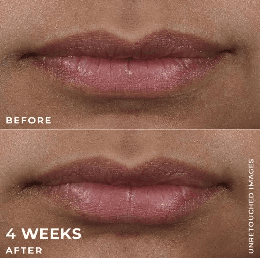 RoC Derm Correxion Lip Volumizer |10ML 3