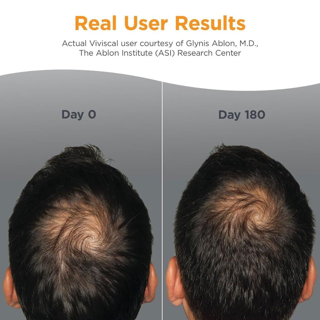 Viviscal Men's Hair Growth Supplements for Thicker, Fuller Hair Clinically Proven with Proprietary Collagen Complex, 60 Tablets 4