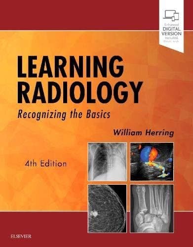 Learning Radiology: Recognizing The Basics
