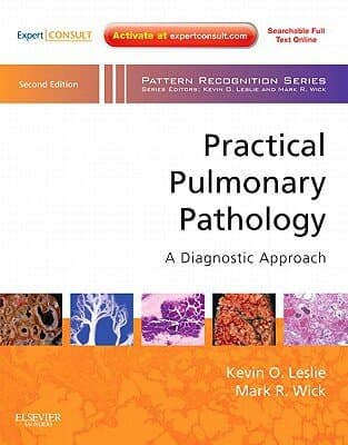 Practical Pulmonary Pathology: A Diagnostic Approach: A Volume In The Pattern Recognition Series