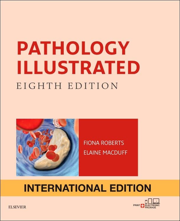 Pathology Illustrated