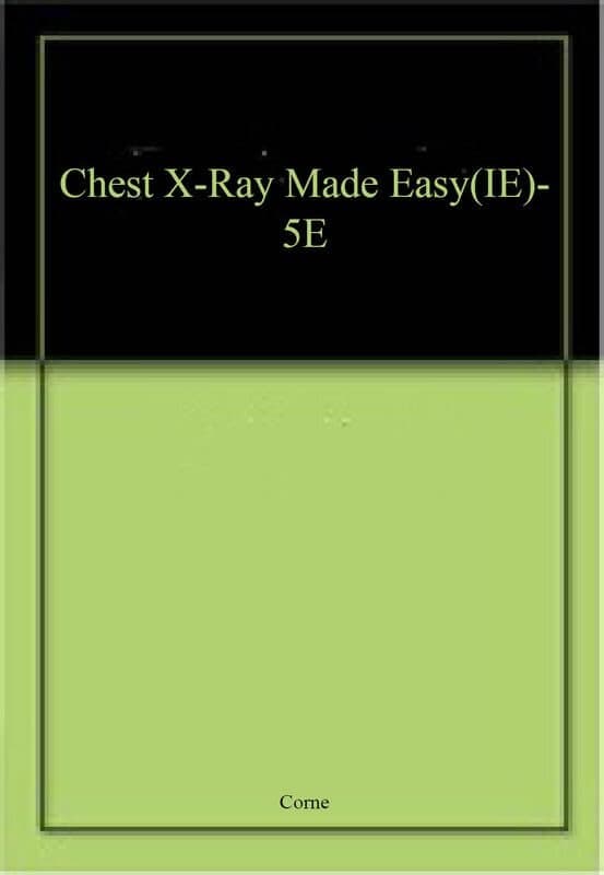 Chest X-Ray Made Easy, International Edition