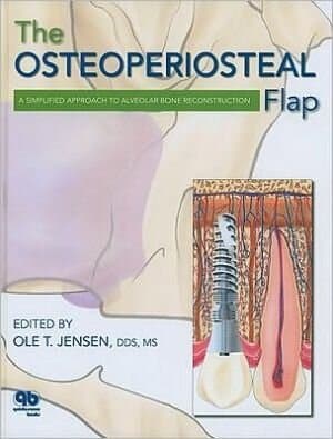 The Osteoperiosteal Flap: A Simplified Approach To Alveolar Bone Reconstruction