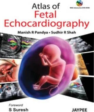 Atlas of Fetal Echocardiography