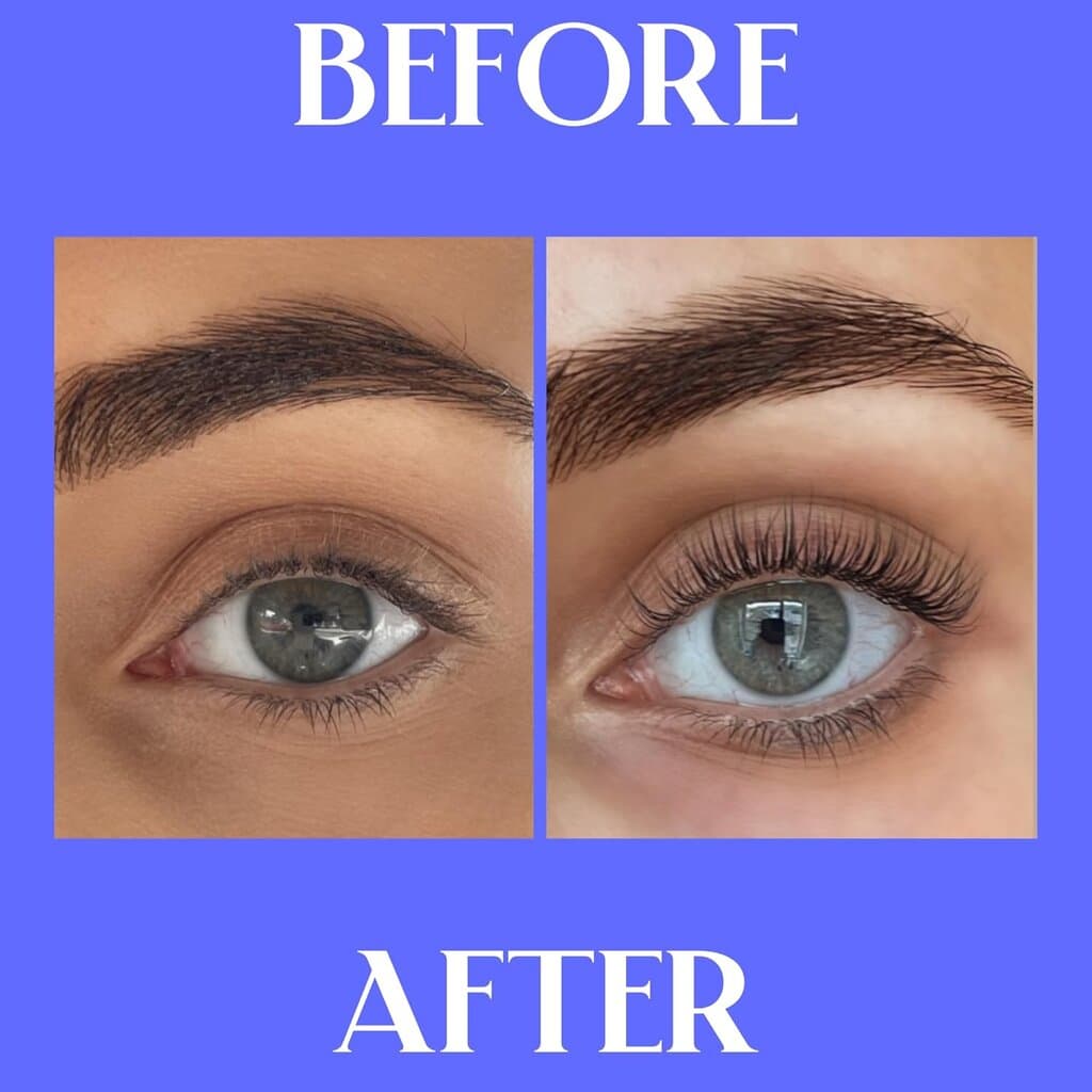 XLash Serum 2