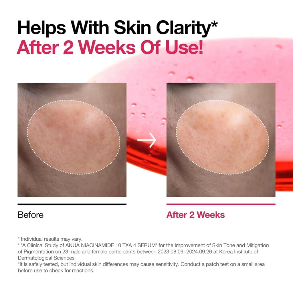 Anua Niacinamide 4