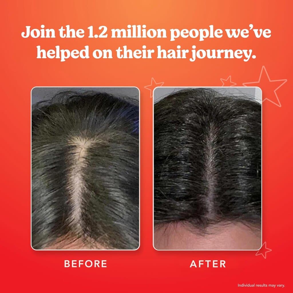 Hairtamin 6