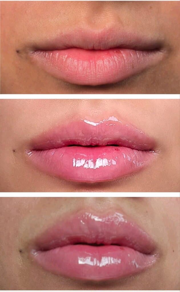 Sydney's Beauty - Lipfiller Plump (EXTREME) 2