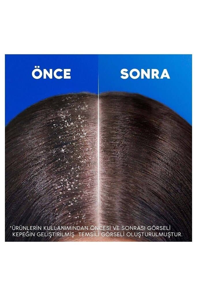 Should Shampoo 330 ML Extra Volume Head STD 4