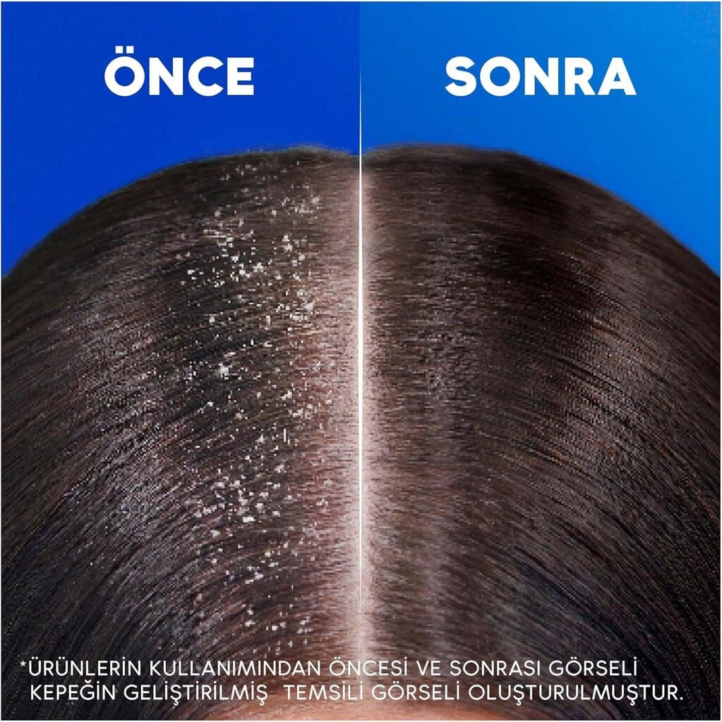 Head & Shoulders Deep Moisturizing Anti-Dandruff Shampoo with Coconut Oil for Daily Use 330ml 5