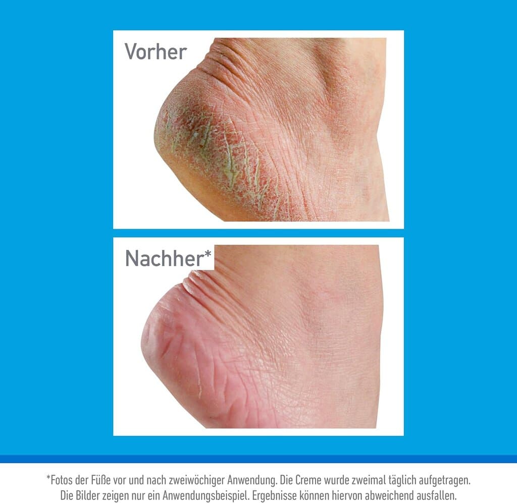 O`Keeffes Healthy Feet Foot Cream - 85ml 3