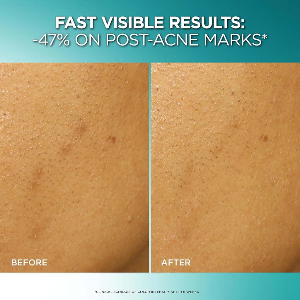 L'Oreal Paris Bright Reveal Dark Spot Exfoliant Peel 4