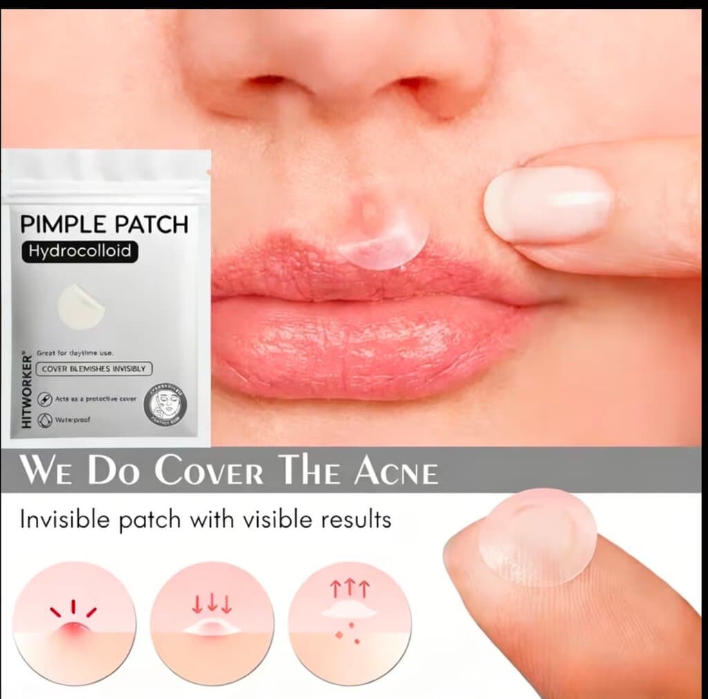Hitworker Hydrocolloid Pimple Patches – 360 Pieces Acne Spot Treatment with Tea Tree & Centella 1