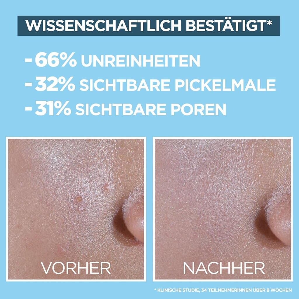 Garnier Vitamine C* Daily UV Anti-pigmentvlekken Fluid Spf50+ - 40ml 5