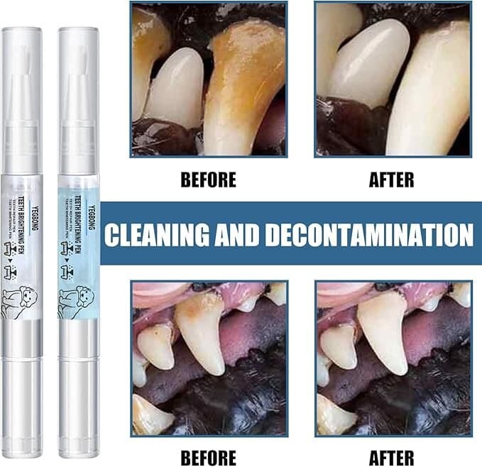 Teeth Cleaning Pen 6