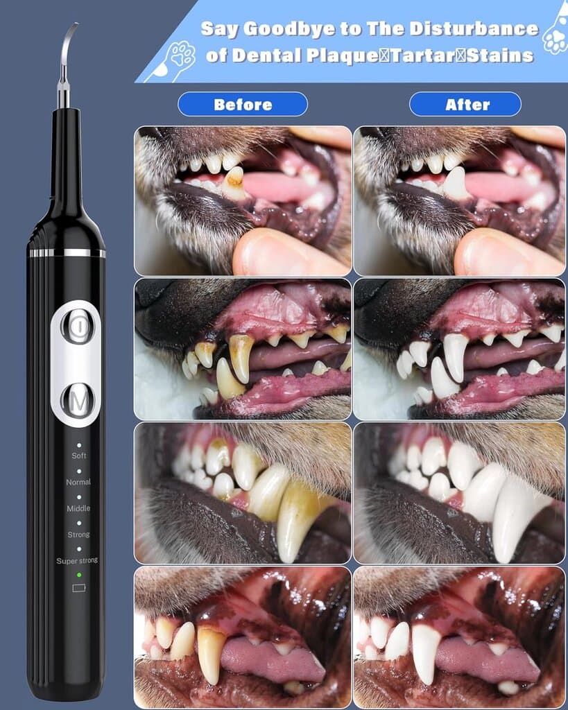 Teeth Cleaner 4
