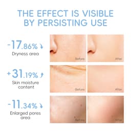 Laikou Moisturizing Facemask Face Sheet Mask — photo 3